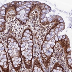 REXO1 Antibody, Novus Biologicals:Antibodies:Primary Antibodies